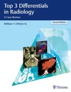 Top 3 Differentials in Radiology: A Case Review af Wiliam T. O'Brien