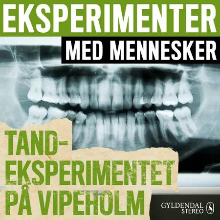 Tandeksperimentet på Vipeholm af Gyldendal Stereo