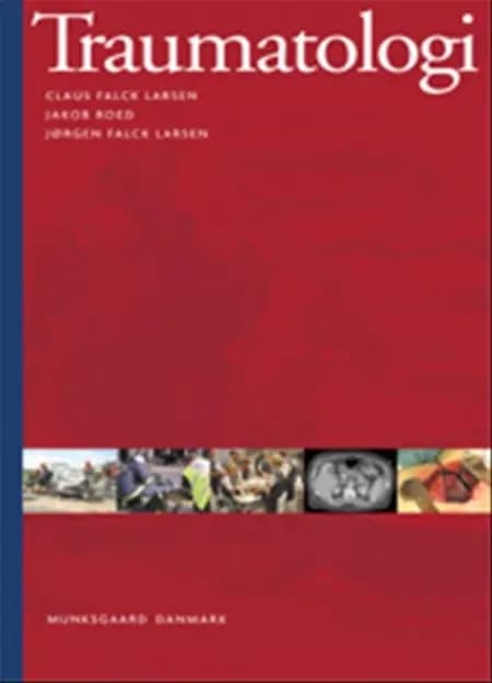 Traumatologi af Jørgen Falck Larsen