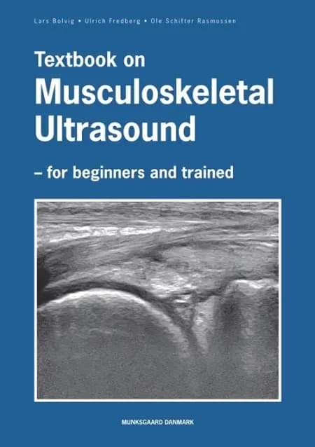 Textbook on Musculoskeletal Ultrasound af Ulrich Fredberg