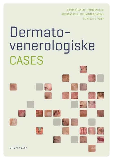 Dermato- venerologiske cases af Niels Veien