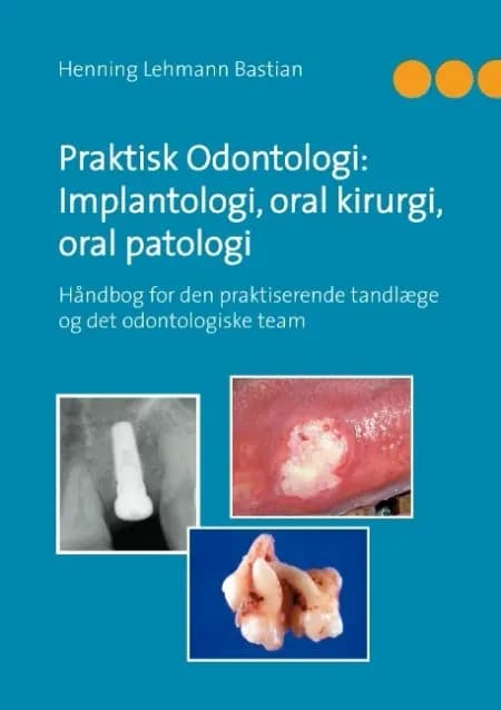 Praktisk odontologi: implantologi, oral kirurgi, oral patologi af Henning Lehmann Bastian