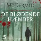 De blødende hænder af Val McDermid