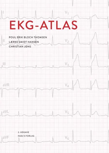 EKG atlas af Poul Erik Bloch Thomsen