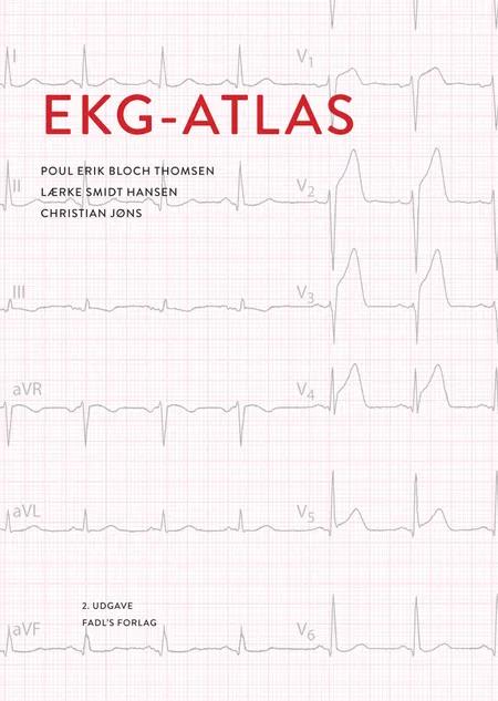 EKG atlas af Poul Erik Bloch Thomsen Christian Jøns