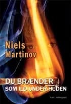 Du brænder som ild under huden af Niels Martinov