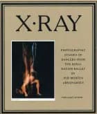 X-ray af Per Morten Abrahamsen